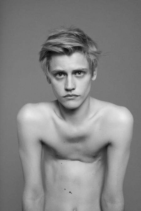 ©Ryan McGinley, Matt (Scar), 2010